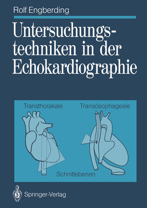 Buchcover Untersuchungstechniken in der Echokardiographie | Rolf Engberding | EAN 9783642741098 | ISBN 3-642-74109-6 | ISBN 978-3-642-74109-8