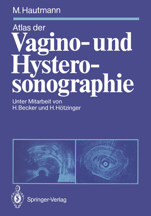 Buchcover Atlas der Vagino- und Hysterosonographie | Maximilian Hautmann | EAN 9783642746482 | ISBN 3-642-74648-9 | ISBN 978-3-642-74648-2