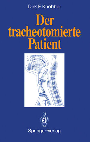 Buchcover Der tracheotomierte Patient | Dirk F. Knöbber | EAN 9783642763373 | ISBN 3-642-76337-5 | ISBN 978-3-642-76337-3
