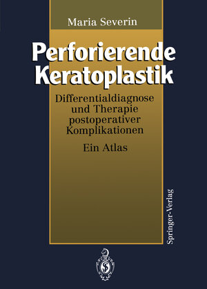 Buchcover Perforierende Keratoplastik | Maria Severin | EAN 9783642790065 | ISBN 3-642-79006-2 | ISBN 978-3-642-79006-5