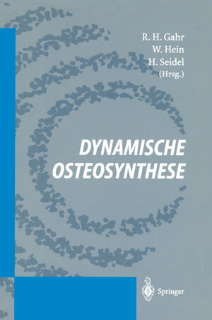 Buchcover Dynamische Osteosynthese  | EAN 9783642795824 | ISBN 3-642-79582-X | ISBN 978-3-642-79582-4