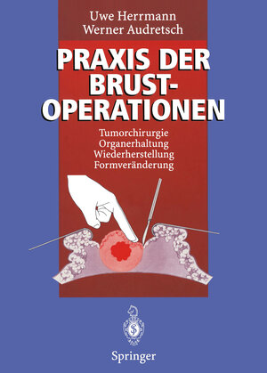 Buchcover Praxis der Brustoperationen | Uwe Herrmann | EAN 9783642796098 | ISBN 3-642-79609-5 | ISBN 978-3-642-79609-8