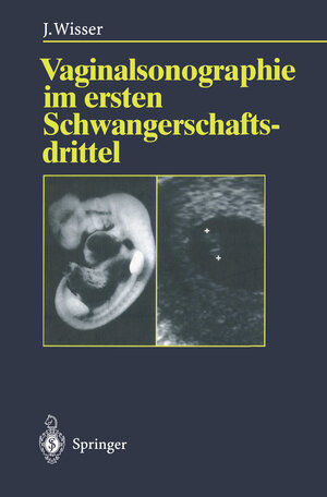 Buchcover Vaginalsonographie im ersten Schwangerschaftsdrittel | Josef Wisser | EAN 9783642798122 | ISBN 3-642-79812-8 | ISBN 978-3-642-79812-2