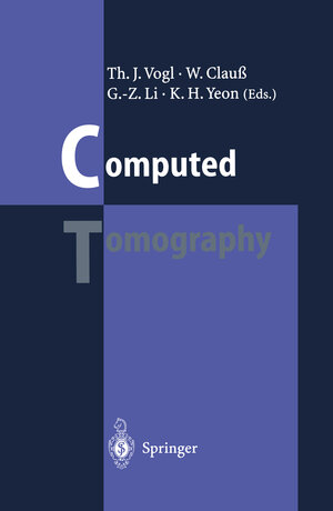 Buchcover Computed Tomography  | EAN 9783642798870 | ISBN 3-642-79887-X | ISBN 978-3-642-79887-0