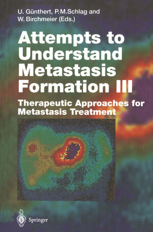 Buchcover Attempts to Understand Metastasis Formation III  | EAN 9783642800719 | ISBN 3-642-80071-8 | ISBN 978-3-642-80071-9