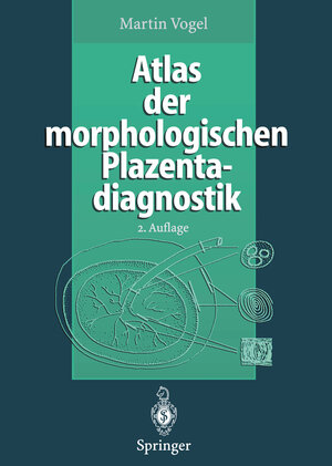Buchcover Atlas der morphologischen Plazentadiagnostik | Martin Vogel | EAN 9783642800849 | ISBN 3-642-80084-X | ISBN 978-3-642-80084-9