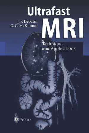 Buchcover Ultrafast MRI | Jörg F. Debatin | EAN 9783642803840 | ISBN 3-642-80384-9 | ISBN 978-3-642-80384-0
