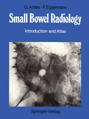 Buchcover Small Bowel Radiology | Günther Antes | EAN 9783642824739 | ISBN 3-642-82473-0 | ISBN 978-3-642-82473-9