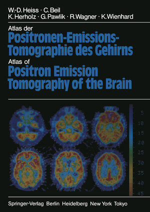 Buchcover Atlas der Positronen-Emissions-Tomographie des Gehirns / Atlas of Positron Emission Tomography of the Brain | W.-D. Heiss | EAN 9783642825668 | ISBN 3-642-82566-4 | ISBN 978-3-642-82566-8