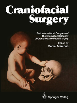 Buchcover Craniofacial Surgery  | EAN 9783642828751 | ISBN 3-642-82875-2 | ISBN 978-3-642-82875-1