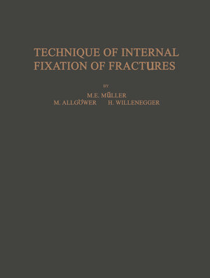 Buchcover Technique of Internal Fixation of Fractures | M. E. Müller | EAN 9783642883583 | ISBN 3-642-88358-3 | ISBN 978-3-642-88358-3