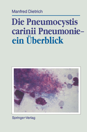 Buchcover Die Pneumocystis carinii Pneumonie— ein Überblick | Manfred Dietrich | EAN 9783642934292 | ISBN 3-642-93429-3 | ISBN 978-3-642-93429-2