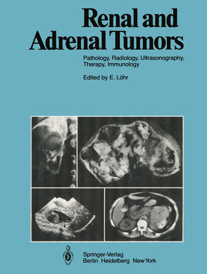 Buchcover Renal and Adrenal Tumors | R. Ackerman | EAN 9783642964947 | ISBN 3-642-96494-X | ISBN 978-3-642-96494-7