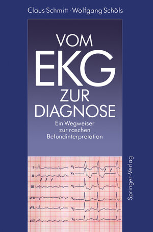 Buchcover Vom EKG zur Diagnose | Claus Schmitt | EAN 9783642974052 | ISBN 3-642-97405-8 | ISBN 978-3-642-97405-2