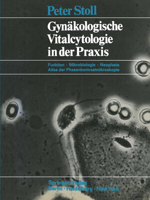 Buchcover Gynäkologische Vitalcytologie in der Praxis | Peter Stoll | EAN 9783662005569 | ISBN 3-662-00556-5 | ISBN 978-3-662-00556-9