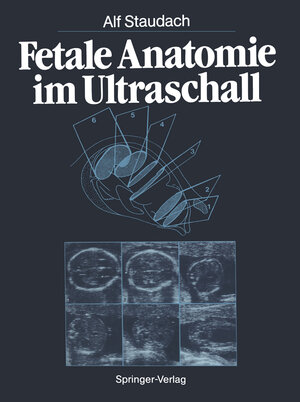 Buchcover Fetale Anatomie im Ultraschall | Alf Staudach | EAN 9783662007914 | ISBN 3-662-00791-6 | ISBN 978-3-662-00791-4