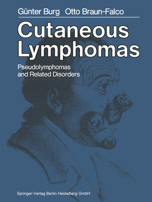 Buchcover Cutaneous Lymphomas, Pseudolymphomas, and Related Disorders | G. Burg | EAN 9783662008881 | ISBN 3-662-00888-2 | ISBN 978-3-662-00888-1