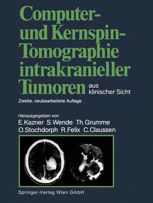 Buchcover Computer- und Kernspin-Tomographie intrakranieller Tumoren aus klinischer Sicht  | EAN 9783662063866 | ISBN 3-662-06386-7 | ISBN 978-3-662-06386-6