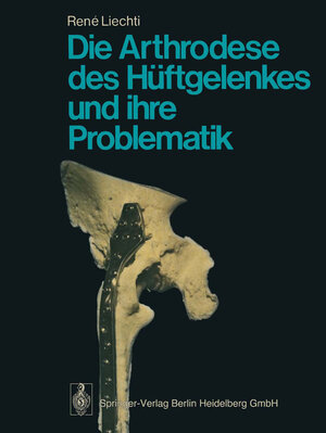 Buchcover Die Arthrodese des Hüftgelenkes und ihre Problematik | R. Liechti | EAN 9783662066256 | ISBN 3-662-06625-4 | ISBN 978-3-662-06625-6