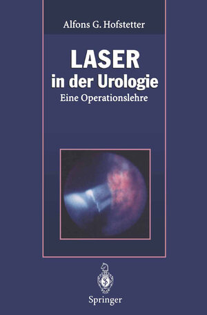 Buchcover Laser in der Urologie  | EAN 9783662082539 | ISBN 3-662-08253-5 | ISBN 978-3-662-08253-9