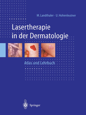 Buchcover Lasertherapie in der Dermatologie | Michael Landthaler | EAN 9783662082737 | ISBN 3-662-08273-X | ISBN 978-3-662-08273-7