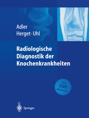 Buchcover Radiologische Diagnostik der Knochenkrankheiten | Claus-Peter Adler | EAN 9783662096611 | ISBN 3-662-09661-7 | ISBN 978-3-662-09661-1