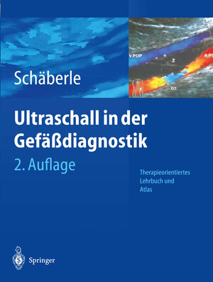 Buchcover Ultraschall in der Gefäßdiagnostik | Wilhelm Schäberle | EAN 9783662106723 | ISBN 3-662-10672-8 | ISBN 978-3-662-10672-3