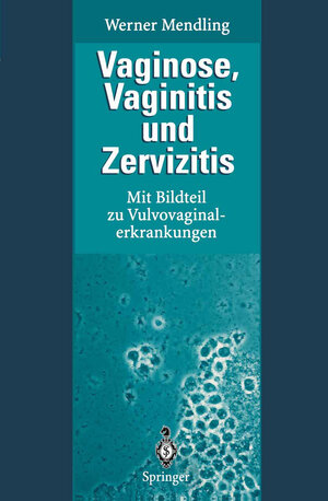 Buchcover Vaginose, Vaginitis und Zervizitis | Werner Mendling | EAN 9783662107393 | ISBN 3-662-10739-2 | ISBN 978-3-662-10739-3