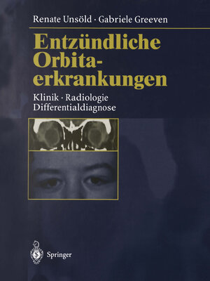 Buchcover Entzündliche Orbitaerkrankungen | Renate Unsöld | EAN 9783662116852 | ISBN 3-662-11685-5 | ISBN 978-3-662-11685-2