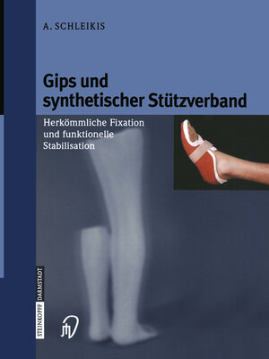 Buchcover Gips und synthetischer Stützverband | A. Schleikis | EAN 9783662118832 | ISBN 3-662-11883-1 | ISBN 978-3-662-11883-2