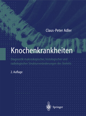 Buchcover Knochenkrankheiten | Claus-Peter Adler | EAN 9783662121603 | ISBN 3-662-12160-3 | ISBN 978-3-662-12160-3