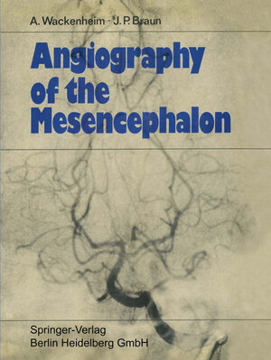 Buchcover Angiography of the Mesencephalon | Auguste Wackenheim | EAN 9783662293843 | ISBN 3-662-29384-6 | ISBN 978-3-662-29384-3