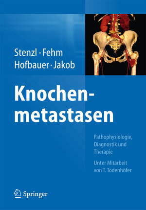 Buchcover Knochenmetastasen  | EAN 9783662434703 | ISBN 3-662-43470-9 | ISBN 978-3-662-43470-3