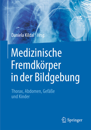 Buchcover Medizinische Fremdkörper in der Bildgebung  | EAN 9783662472958 | ISBN 3-662-47295-3 | ISBN 978-3-662-47295-8