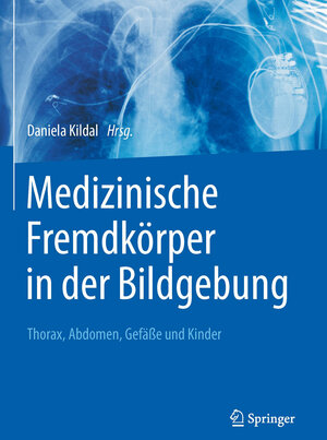 Buchcover Medizinische Fremdkörper in der Bildgebung  | EAN 9783662472965 | ISBN 3-662-47296-1 | ISBN 978-3-662-47296-5