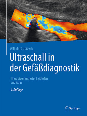 Buchcover Ultraschall in der Gefäßdiagnostik | Wilhelm Schäberle | EAN 9783662474310 | ISBN 3-662-47431-X | ISBN 978-3-662-47431-0
