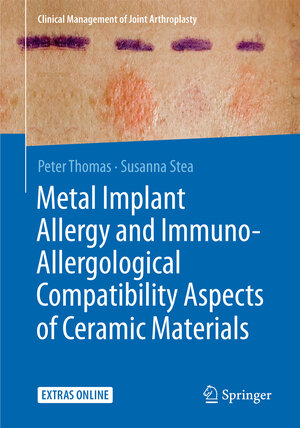 Buchcover Metal Implant Allergy and Immuno-Allergological Compatibility Aspects of Ceramic Materials | Peter Thomas | EAN 9783662474402 | ISBN 3-662-47440-9 | ISBN 978-3-662-47440-2