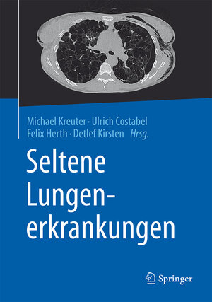 Buchcover Seltene Lungenerkrankungen  | EAN 9783662484197 | ISBN 3-662-48419-6 | ISBN 978-3-662-48419-7