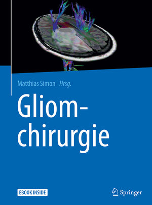 Buchcover Gliomchirurgie  | EAN 9783662486948 | ISBN 3-662-48694-6 | ISBN 978-3-662-48694-8