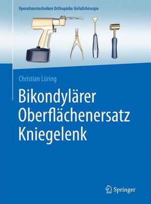 Buchcover Bikondylärer Oberflächenersatz Kniegelenk | Christian Lüring | EAN 9783662491461 | ISBN 3-662-49146-X | ISBN 978-3-662-49146-1