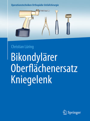 Buchcover Bikondylärer Oberflächenersatz Kniegelenk | Christian Lüring | EAN 9783662491478 | ISBN 3-662-49147-8 | ISBN 978-3-662-49147-8