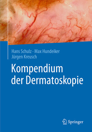 Buchcover Kompendium der Dermatoskopie | Hans Schulz | EAN 9783662494905 | ISBN 3-662-49490-6 | ISBN 978-3-662-49490-5