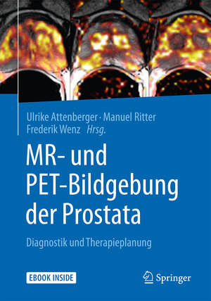 Buchcover MR- und PET-Bildgebung der Prostata  | EAN 9783662504673 | ISBN 3-662-50467-7 | ISBN 978-3-662-50467-3