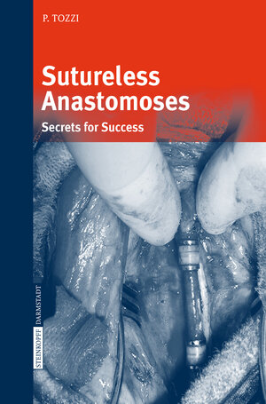 Buchcover Sutureless Anastomoses | Piergiorgio Tozzi | EAN 9783662526866 | ISBN 3-662-52686-7 | ISBN 978-3-662-52686-6