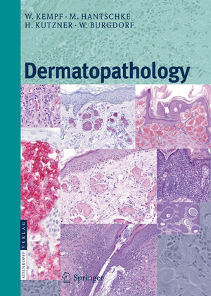 Buchcover Dermatopathology | Werner Kempf | EAN 9783662526873 | ISBN 3-662-52687-5 | ISBN 978-3-662-52687-3