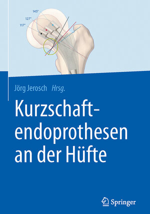 Buchcover Kurzschaftendoprothesen an der Hüfte  | EAN 9783662527443 | ISBN 3-662-52744-8 | ISBN 978-3-662-52744-3