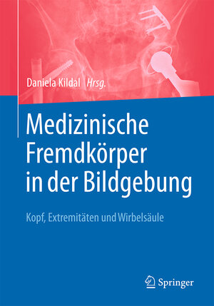 Buchcover Medizinische Fremdkörper in der Bildgebung  | EAN 9783662537497 | ISBN 3-662-53749-4 | ISBN 978-3-662-53749-7