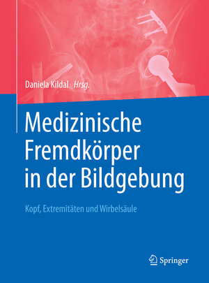 Buchcover Medizinische Fremdkörper in der Bildgebung  | EAN 9783662537503 | ISBN 3-662-53750-8 | ISBN 978-3-662-53750-3
