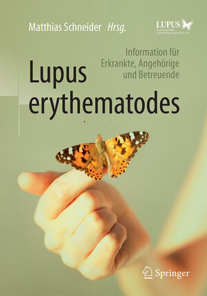 Buchcover Lupus erythematodes  | EAN 9783662538449 | ISBN 3-662-53844-X | ISBN 978-3-662-53844-9