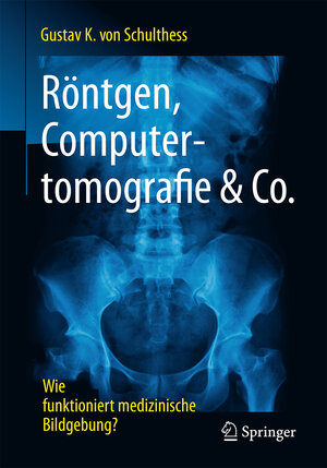 Buchcover Röntgen, Computertomografie & Co. | Gustav K. von Schulthess | EAN 9783662539309 | ISBN 3-662-53930-6 | ISBN 978-3-662-53930-9
